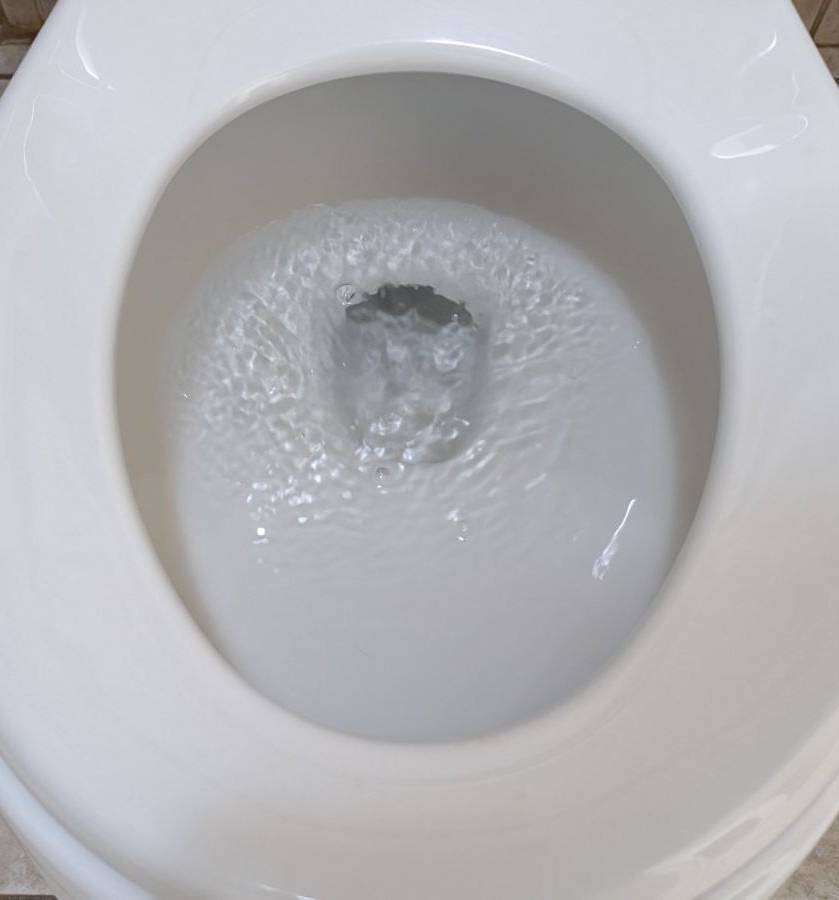 Stained Toilet Bowl After
